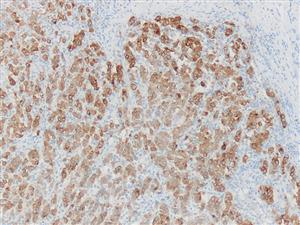 3580A | Control Slides:Immunopathology; Melan-A (MART-1)